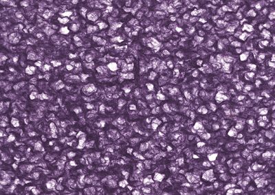 Lace – Purple
